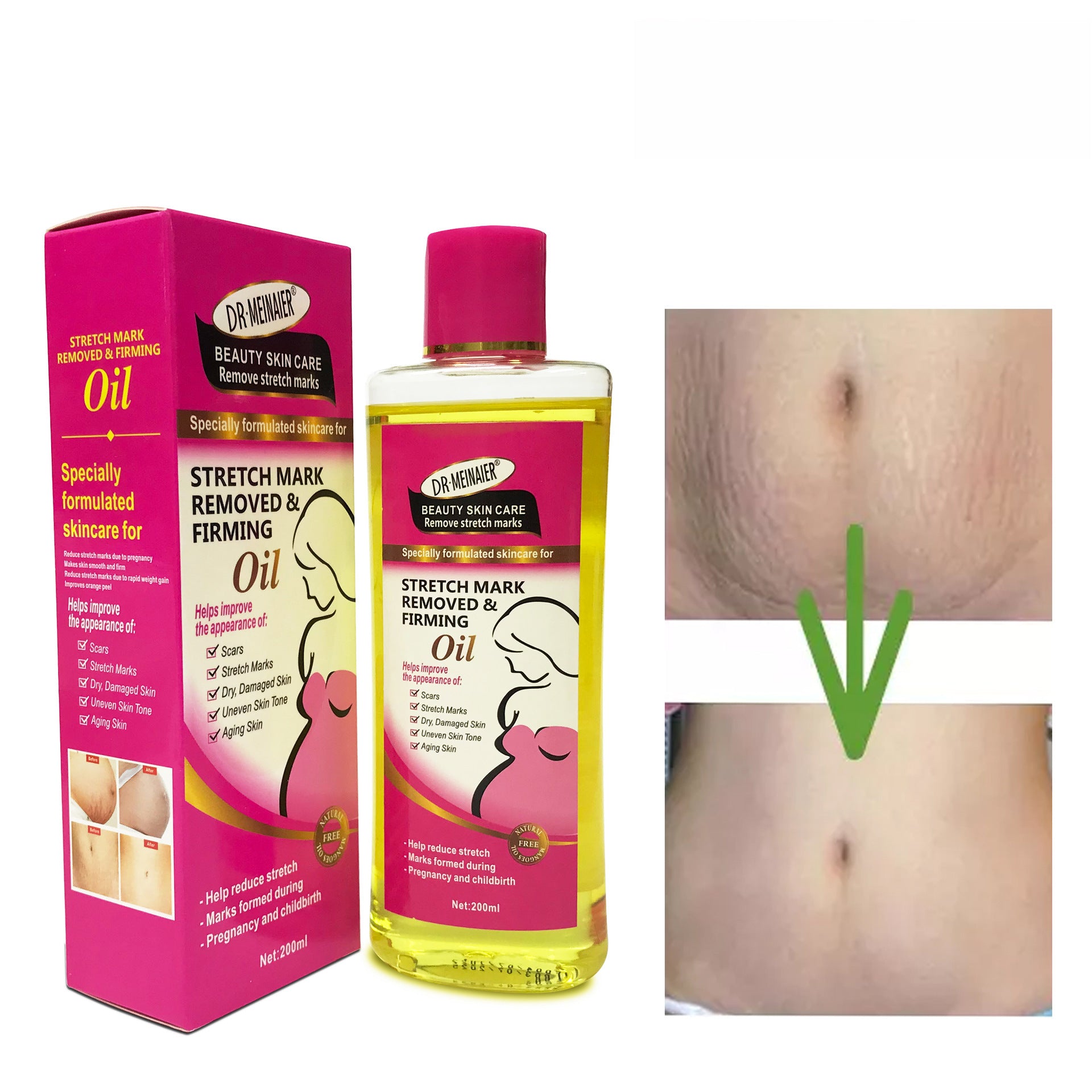 Stretch Marks Multi-Effect Moisturizing Soothing Oil